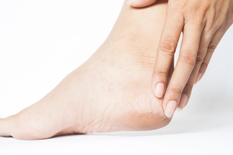 woman-cracked-heels-with-white-background-foot-healthy-concept